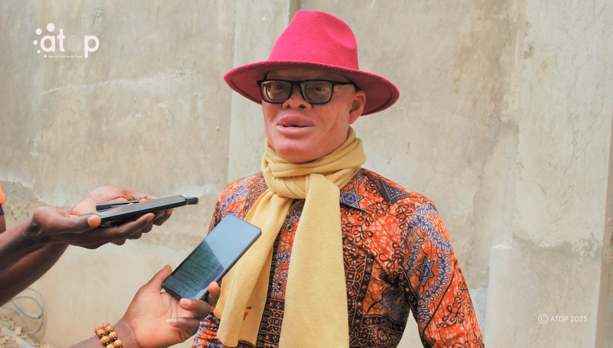 Albinisme au Togo : entre stigmatisation et quête de reconnaissance 1 Oliver 10