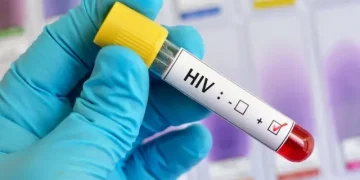 VIH : la stratégie togolaise pour réduire les contaminations à la source 5 VIH : la stratégie togolaise pour réduire les contaminations à la source